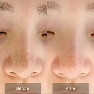 salon Shri所属・かとう みきのエステ・リラクイメージ