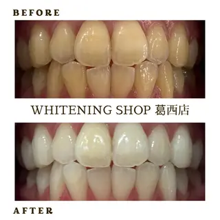 メンズ ホワイトニング ショップ葛西店のその他イメージ