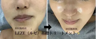 🩵Tatsumi Kana🩵のエステ・リラクイメージ