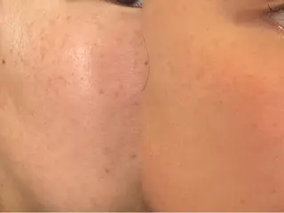 La・Bellvie所属・La･Bellvie 【星ヶ丘店]のエステ・リラクイメージ