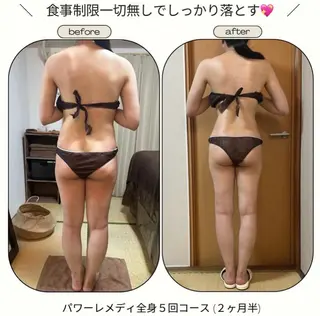 《本気痩せ×疲労改善 》  BILOOPのエステ・リラクイメージ