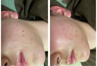 🔰 新米ネイリストのネイルデザイン