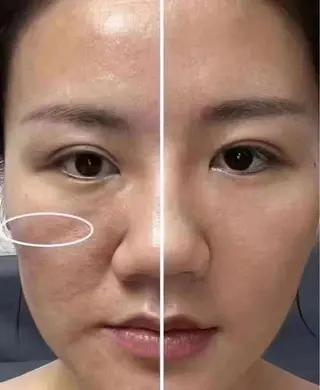 ネイル aliaハーブ水光店 エステティシャン募集のエステ・リラクイメージ