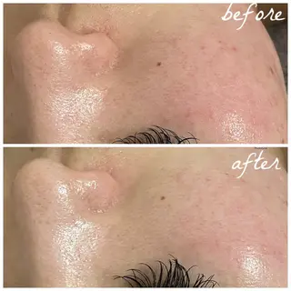 メンズ メナード岐阜市茜部 杉浦のエステ・リラクイメージ