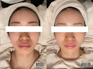 ポテンツァ&針美容 バストアップ専門店のエステ・リラクイメージ