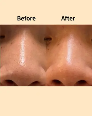 Novelle所属・nozomi.m🌷 narisのエステ・リラクイメージ