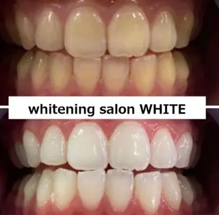 whitening salon WHITE 広島店所属・セルフホワイトニング 専門店WHITE広島のその他イメージ