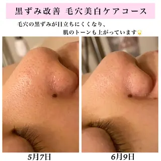 Bellesthe (ベルエステ)のエステ・リラクイメージ