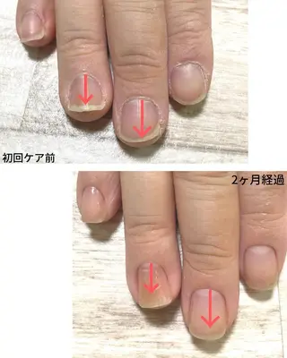 ネイル 自爪育成専門店 Kapilinaのネイルデザイン