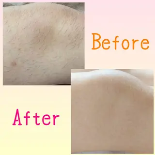 毛穴洗浄🍀脱毛🍀 光フェイシャル🍀のエステ・リラクイメージ