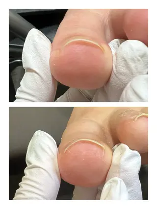 ネイル 巻き爪補正店 堺東店のネイルデザイン