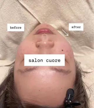 salon cuore豊中服部のエステ・リラクイメージ