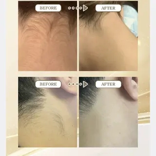 beauty salon  link所属・水素エステと美容脱毛 salon Linkのエステ・リラクイメージ