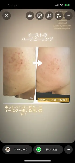 クリスタラン イーストのエステ・リラクイメージ