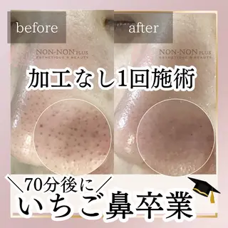 NON-NONプラス 大人の本気痩身のエステ・リラクイメージ