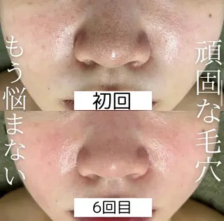 韓国美肌/肌質改善 【天神】のエステ・リラクイメージ