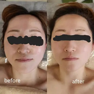 Shiny ✧︎*。のエステ・リラクイメージ