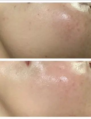 ICHOOSE/ 代々木上原のエステ・リラクイメージ