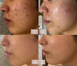 小顔&美肌品川店 Masqueradeのエステ・リラクイメージ