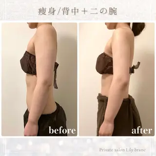 Lily branc 痩身/小顔/肌質改善のエステ・リラクイメージ