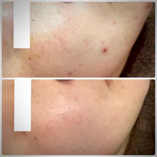 Muqu. 毛穴サロンのエステ・リラクイメージ