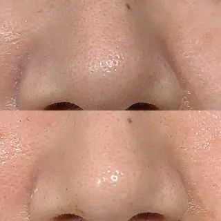 BEAUTYSARON　SiS.所属・高橋 沙奈江のエステ・リラクイメージ