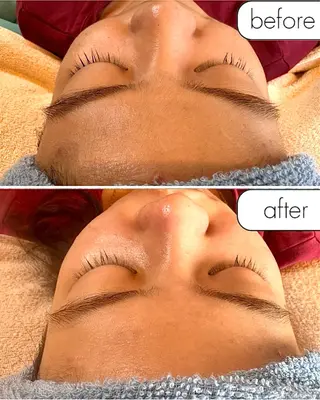 蝶式糸除毛専門salon aco所属・糸除毛専門salon acoのエステ・リラクイメージ