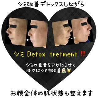 ヴィーナス ビューティーのエステ・リラクイメージ