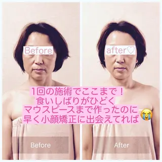 小顔矯正&ヘッドスパ haruhandのエステ・リラクイメージ