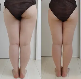 佐賀 痩身・美肌 @uni.clearのエステ・リラクイメージ