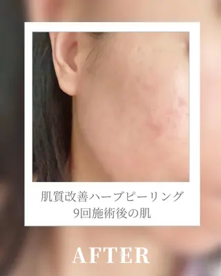 🎀BiBi韓国美容 コスパ強！美活サロンのエステ・リラクイメージ