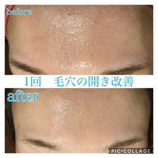 ショート カラー パーマ ヘアアレンジ メンズ ネイル マツエク・マツパ EnsorClair 代表 野口真央のエステ・リラクイメージ