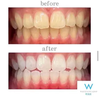 メンズ キッズ ホワイトニング ショップ町田店のその他イメージ