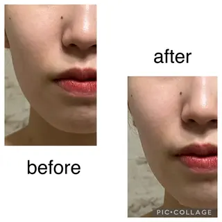 M.rose エムローズのエステ・リラクイメージ