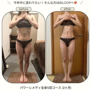 《本気痩せ×疲労改善 》  BILOOPのエステ・リラクイメージ