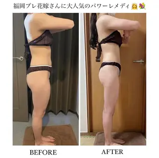 《本気痩せ×疲労改善 》  BILOOPのエステ・リラクイメージ