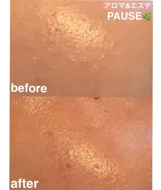 浜野 恵美のエステ・リラクイメージ