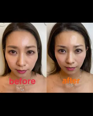 美容鍼灸サロン mahoroba院長のエステ・リラクイメージ