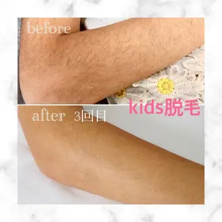 キッズ 脱毛&フェイシャル NO.511のエステ・リラクイメージ