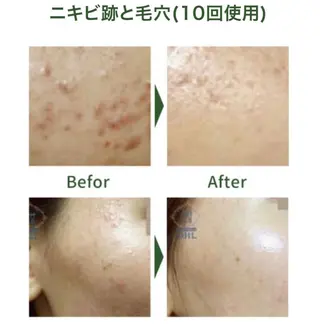 上坂 祐以のエステ・リラクイメージ