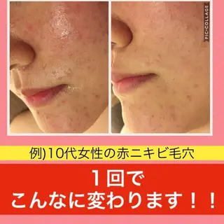 ミディアム カラー パーマ ヘアアレンジ メンズ キッズ ネイル マツエク・マツパ ニキビ・肌質改善専門 ♡人生が変わるサロンのエステ・リラクイメージ