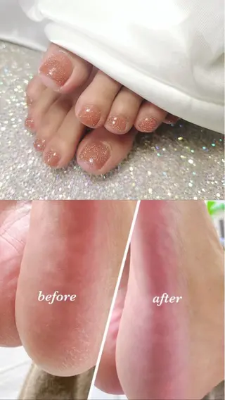 ネイル スパアンドネイル チルのエステ・リラクイメージ