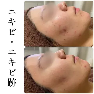 ハーブピーリング専門 BIOEL横浜のエステ・リラクイメージ