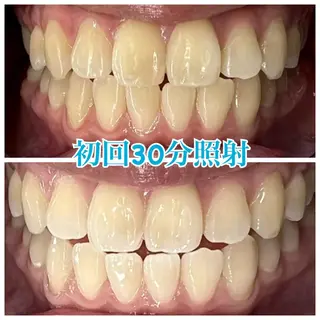ホワイトニング🦷 ネイル💅LEAのその他イメージ