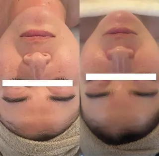 中目黒ハーブピーリン グ🌿ララピールのエステ・リラクイメージ