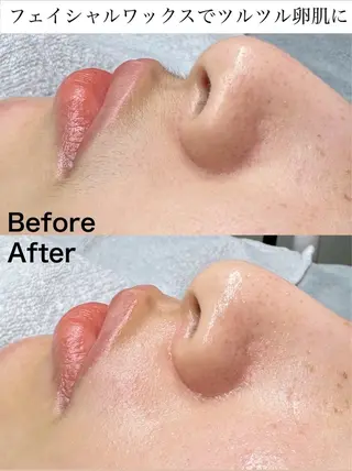 マツヤニWax専門/ 岸和田/Luanaのエステ・リラクイメージ