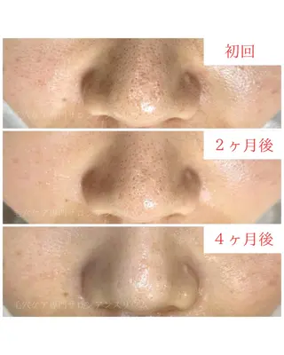 茨城土浦 つくば毛穴 ケア専門サロンのエステ・リラクイメージ