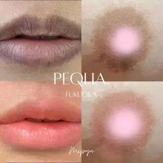 【フェムケア専門店】 PEQLIA福岡のエステ・リラクイメージ