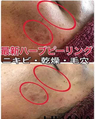 LILIANA ☆YURIのエステ・リラクイメージ