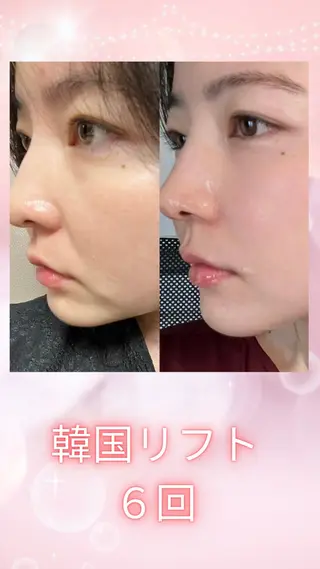 マツエク・マツパ 愛維美水光美肌専門店 メンズレディースokのエステ・リラクイメージ